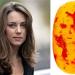 Man Finds Kate Middleton's Face in Jellybean