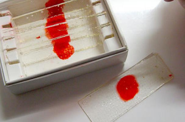 Dexter Blood Slide Suckers