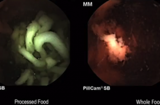What Ramen Looks Like in Your Stomach